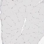CD82 Antibody in Immunohistochemistry (Paraffin) (IHC (P))