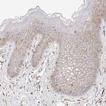 CD82 Antibody in Immunohistochemistry (Paraffin) (IHC (P))