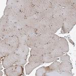 HOXC8 Antibody in Immunohistochemistry (Paraffin) (IHC (P))