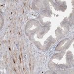 BHLHE40 Antibody in Immunohistochemistry (Paraffin) (IHC (P))