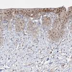 BHLHE40 Antibody in Immunohistochemistry (Paraffin) (IHC (P))