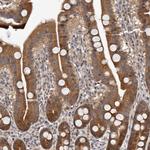 TXNL2 Antibody in Immunohistochemistry (Paraffin) (IHC (P))