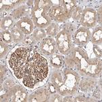 TXNL2 Antibody in Immunohistochemistry (Paraffin) (IHC (P))