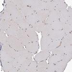 TXNL2 Antibody in Immunohistochemistry (Paraffin) (IHC (P))