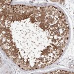 TXNL2 Polyclonal Antibody