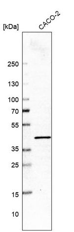 TXNL2 Antibody in Western Blot (WB)