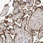 RILPL2 Antibody in Immunohistochemistry (Paraffin) (IHC (P))