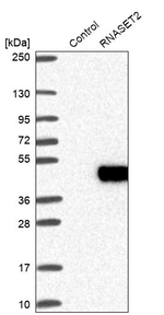 RNASET2 Antibody in Western Blot (WB)