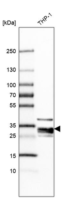 RNASET2 Antibody in Western Blot (WB)
