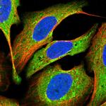 SMYD2 Polyclonal Antibody