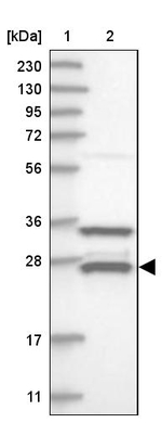 ETHE1 Antibody in Western Blot (WB)