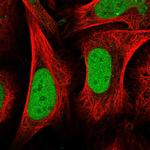 CENPQ Antibody in Immunocytochemistry (ICC/IF)