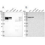 PPP2R5D Antibody in Western Blot (WB)