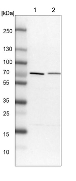 PPP2R5D Antibody in Western Blot (WB)