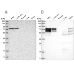 PPP2R5D Antibody in Western Blot (WB)