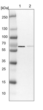 PPP2R5D Antibody in Western Blot (WB)