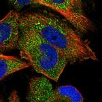 PP5 Polyclonal Antibody