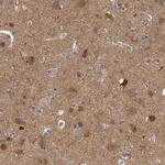 PP5 Antibody in Immunohistochemistry (Paraffin) (IHC (P))