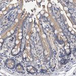 PP5 Antibody in Immunohistochemistry (Paraffin) (IHC (P))