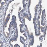 PP5 Antibody in Immunohistochemistry (Paraffin) (IHC (P))