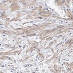PP5 Antibody in Immunohistochemistry (Paraffin) (IHC (P))