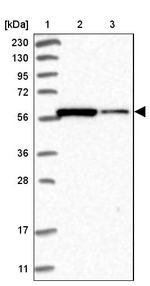 PP5 Antibody in Western Blot (WB)