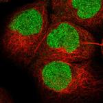 FALZ Polyclonal Antibody