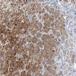 FALZ Antibody in Immunohistochemistry (Paraffin) (IHC (P))