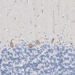 FALZ Antibody in Immunohistochemistry (Paraffin) (IHC (P))