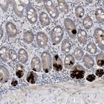 FALZ Antibody in Immunohistochemistry (Paraffin) (IHC (P))