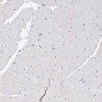 FALZ Antibody in Immunohistochemistry (Paraffin) (IHC (P))