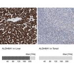 ALDH6A1 Antibody