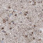 ALDH6A1 Antibody in Immunohistochemistry (Paraffin) (IHC (P))