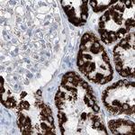 ALDH6A1 Antibody in Immunohistochemistry (Paraffin) (IHC (P))