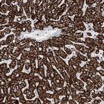 ALDH6A1 Antibody in Immunohistochemistry (Paraffin) (IHC (P))