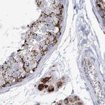 ALDH6A1 Antibody in Immunohistochemistry (Paraffin) (IHC (P))
