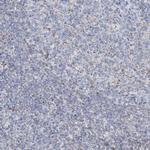 ALDH6A1 Antibody in Immunohistochemistry (Paraffin) (IHC (P))