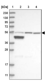 ALDH6A1 Antibody in Western Blot (WB)
