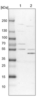 ALDH6A1 Antibody in Western Blot (WB)
