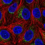 ALDH6A1 Polyclonal Antibody