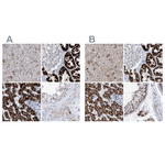 ALDH6A1 Antibody in Immunohistochemistry (Paraffin) (IHC (P))
