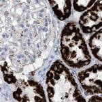 ALDH6A1 Antibody in Immunohistochemistry (Paraffin) (IHC (P))