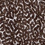 ALDH6A1 Antibody in Immunohistochemistry (Paraffin) (IHC (P))