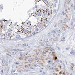 ALDH6A1 Antibody in Immunohistochemistry (Paraffin) (IHC (P))