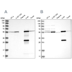 ALDH6A1 Antibody in Western Blot (WB)