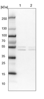ALDH6A1 Antibody in Western Blot (WB)