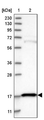 eIF5A2 Antibody in Western Blot (WB)