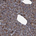 MAPKAP1 Polyclonal Antibody