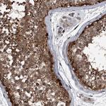 MAPKAP1 Antibody in Immunohistochemistry (Paraffin) (IHC (P))