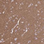 SEPT5 Antibody in Immunohistochemistry (Paraffin) (IHC (P))